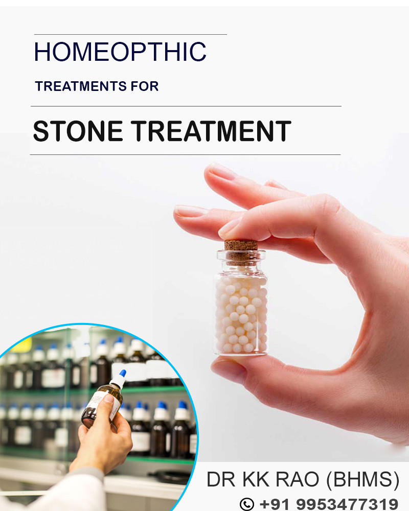 Homoeopathy stone treatment in Gurgaon